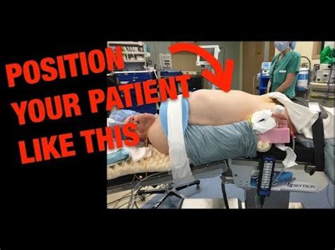 Robotic Right Colectomy Patient Positioning Youtube