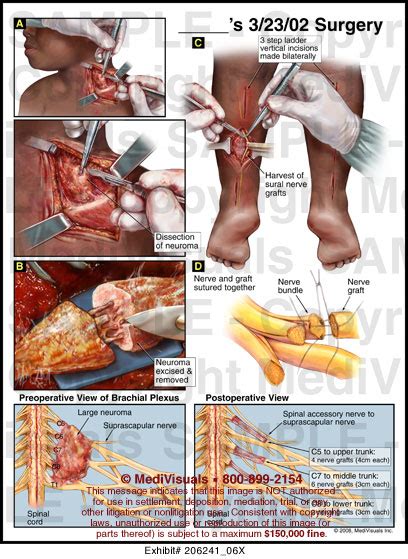 Medivisuals Surgery Medical Illustration