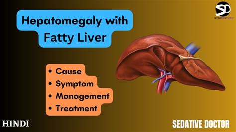 Hepatomegaly With Fatty Liver Treatment And Management Hindi