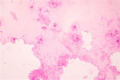 Anatomi Dan Histologis Ovarium Testis Dan Sperma Sel Manusia Di Bawah Mikroskop Foto Stok