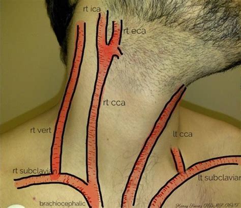 Arteries In Neck Arteries In Neck And Head Arteries Head Neck 2