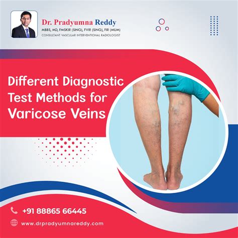 Different Diagnostic Test Methods For Varicose Veins