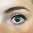 I Have Partial Heterchromia  One Eye That Is Two Different Colours
