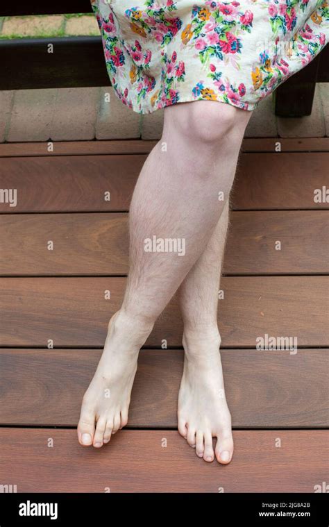 Hairy Legs Woman Hi Res Stock Photography And Images Alamy