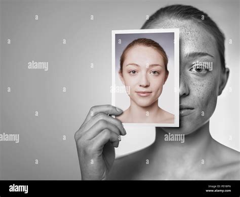 Sun Skin Damage Hi Res Stock Photography And Images Alamy