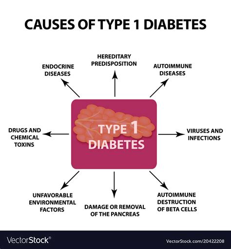 Causes diabetes type 1 infographics Royalty Free Vector