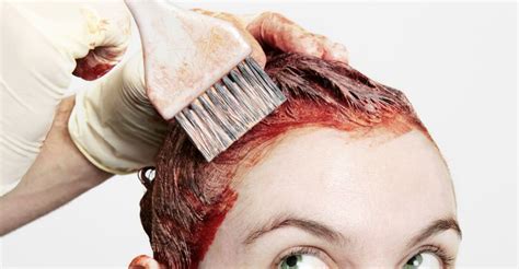 Allergic skin reactions, also called allergic contact dermatitis, can occur even after having had contact to a substance for many years. Woman's Head Looks Like It's About Explode After Allergic ...