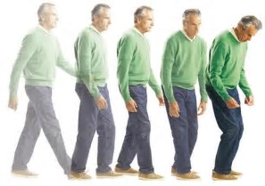 Image result for image of person with parkinson's