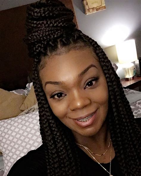 Natural Braided Hairstyles Brace Face Box Braids Braces Natural