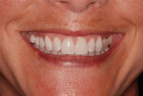 From Vision To Reality Creating A Beautiful Smile Dental Health Concepts