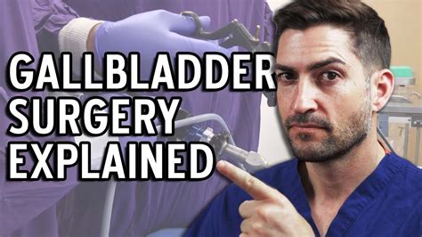 Gallbladder Surgery Explained Complications And Recovery Youtube