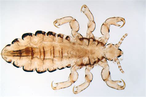 Lice Faqs Lice Clinic Dfw