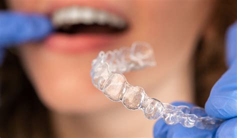 Discover The Advantages Of Invisalign For Orthodontic Treatment