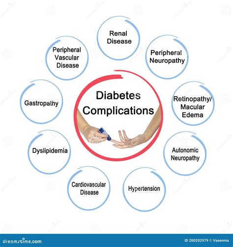 Eight Complications Of Diabetes Stock Illustration Illustration Of