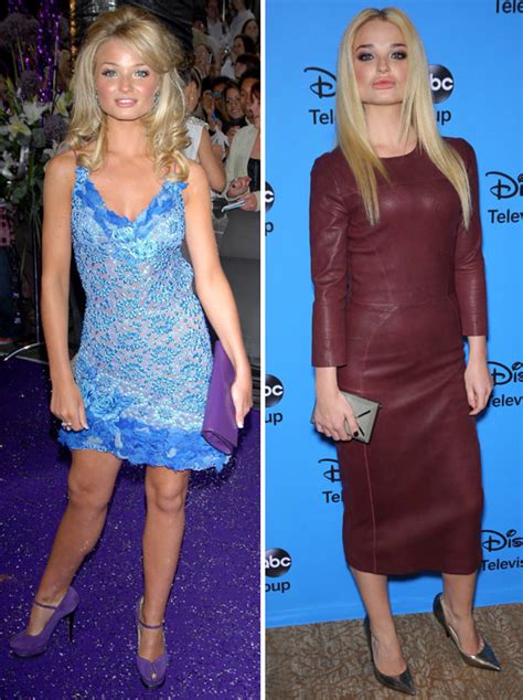 Emma Rigby Ex Hollyoaks Actress Reveals Hollywood Makeover Pictures