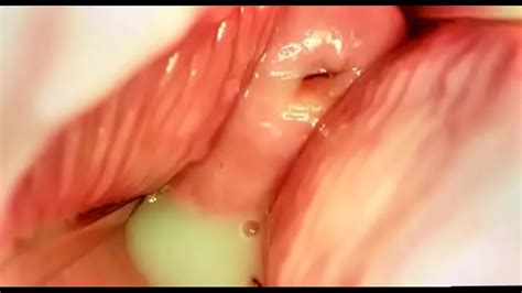 Camera inside Vagina filled with semen XNXX国内免翻墙优化版