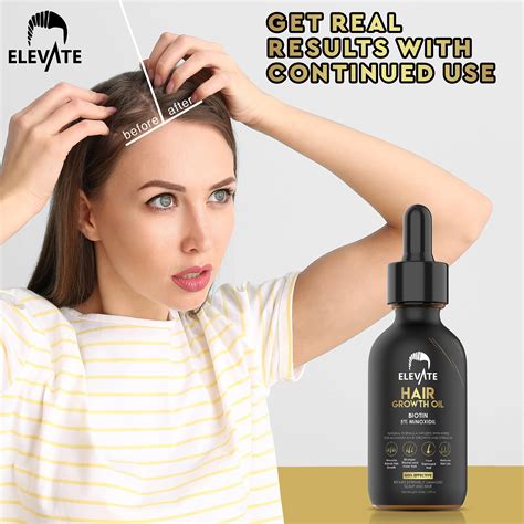 elevate hair growth oil biotin hair growth serum and 5 minoxidil treatment for stronger thicker
