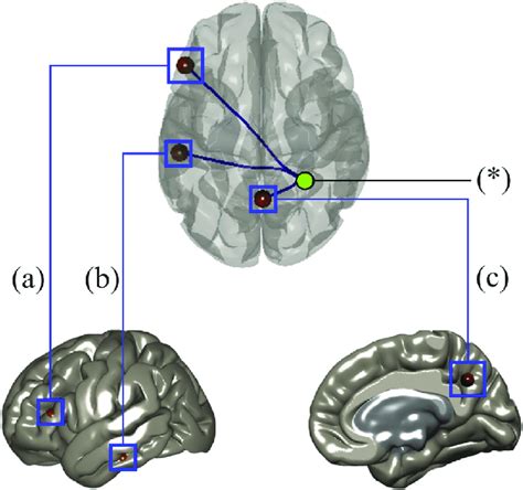 Significant Regions Of Interest With The Right Superior Parietal Lobule