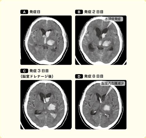 Doujin music | 同人音楽 8 янв 2015 в 18:38. 心に強く訴える 脳室 解剖 Ct - 私たちはソガトです