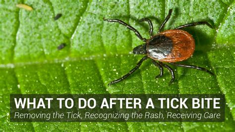 What To Do After A Tick Bite Johns Hopkins Rheumtv