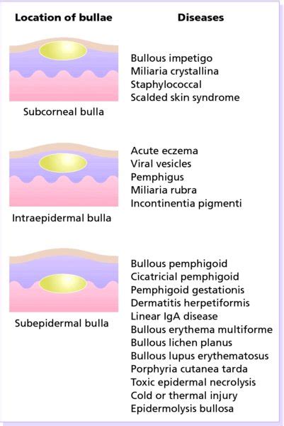 Bullous Diseases Plastic Surgery Key