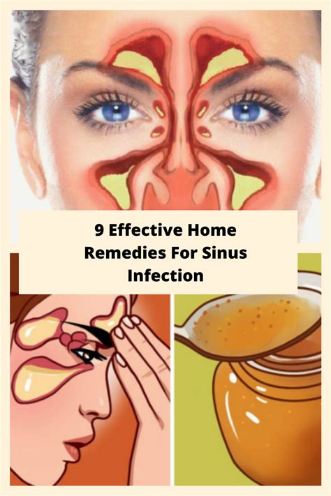 9 Effective Home Remedies For Sinus Infection