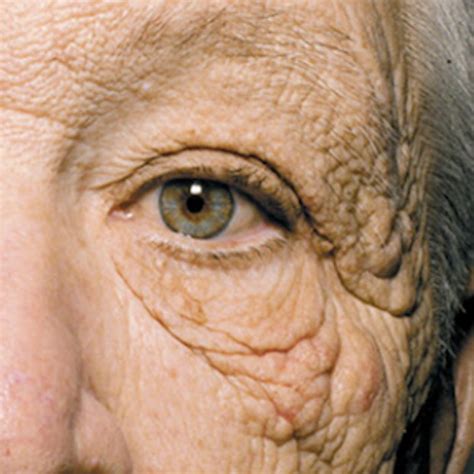 What Does 28 Years Of Sun Damage Look Like This Upworthy