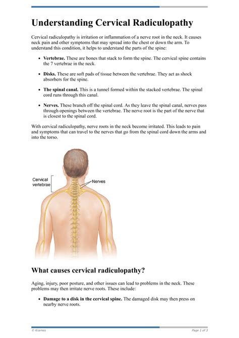 Text Understanding Cervical Radiculopathy Healthclips Online