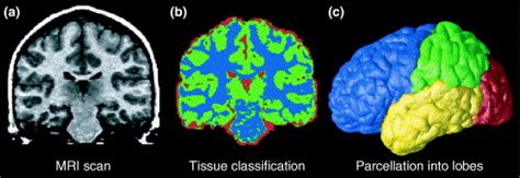 Mapping Brain Maturation Trends In Neurosciences