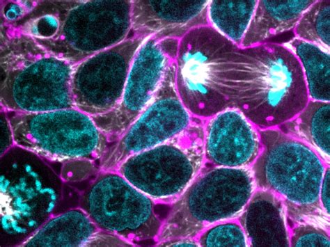 Glowing Human Cells May Shed Light On Sickness And Health Kuow News