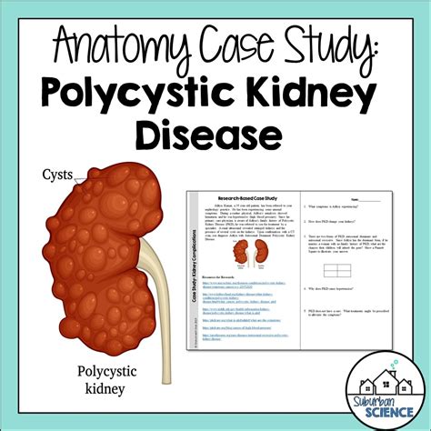 Anatomy Case Study Polycystic Kidney Disease Suburban Science