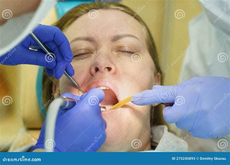 The Dentist Treats The Teeth Of The Patient In The Clinic Stock Image