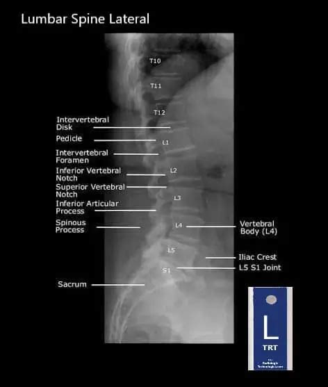 Student Study Guide Lumbar Spine Anatomy