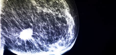 17 subtle signs you may have breast cancer best lif Metal test could help diagnose breast cancer early ...
