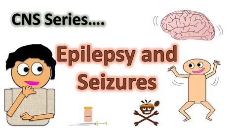 Epilepsy And Seizures Subtlefocalmyoclonic Seizures Cns Series