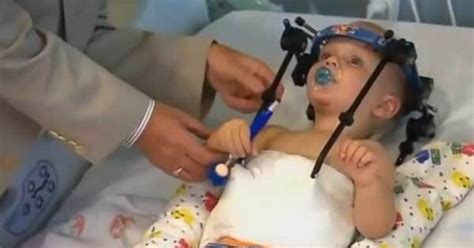 Decapitated Toddler Has Head Reattached By Surgeons After Car Crash
