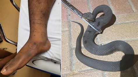 Florida Man Bitten By Venomous Snake Outside Of Home