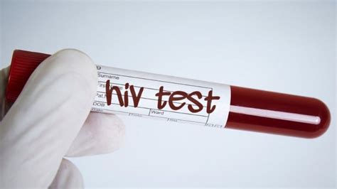 Are We Winning The Fight Against Hiv Bbc News