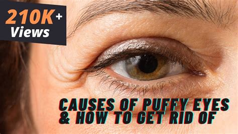what causes puffy eyes and how to get rid of it cosmetic expert dr debraj shome explains youtube