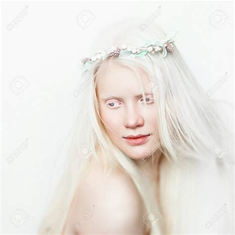 Teen Albino Naked Telegraph