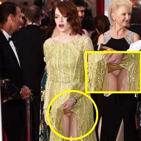 Emma Stone Pussy Slipped Redhead Actress Oopsies