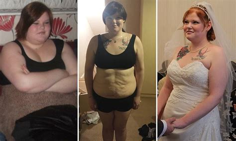 Woman Says She Regrets Having A Gastric Bypass At 16 Daily Mail Online