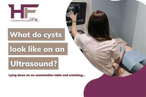 What Do Cysts Look Like On An Ultrasound HealthFinder