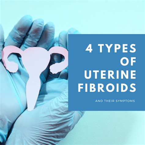 Types Of Uterine Fibroids And Their Symptoms New York City Fibroid Center