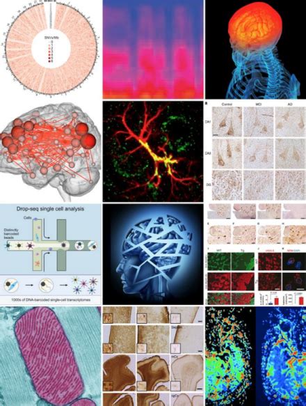 Ninds A Look Back At 2015 National Institute Of Neurological