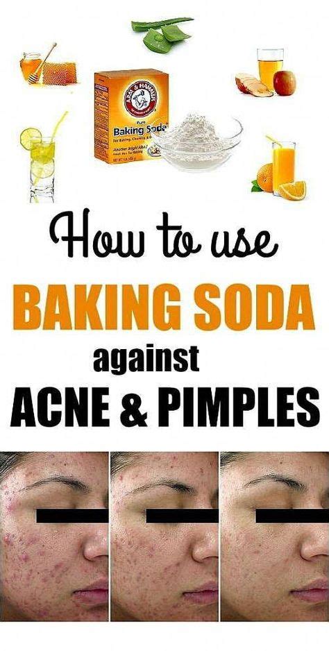 Simple Steps To Follow To Get Rid Of Acne How To Treat Acne Natural