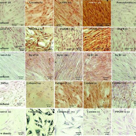Lmsc Expression After Being Cultured Of Devitalized Sheep Lung Tissue