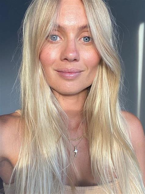 Model Elyse Knowles Reveals How She Got Rid Of Acne During Pregnancy