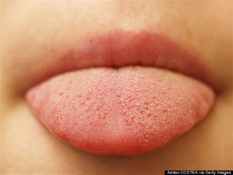 8 Things You Probably Didnt Know About Your Tongue