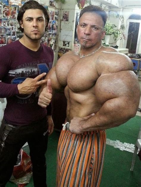 This Guy Uses Way Too Much Synthol Others